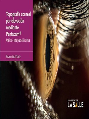 cover image of Topografía corneal por elevación mediante Pentacam&#174;
